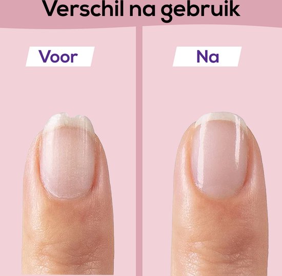 SafeCare Baby Nagelfilset – Elektrisk, Säker och Tyst Filning för Bebisar